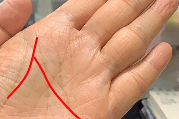 女人右手假断掌的命运解析：命理与生活的关联