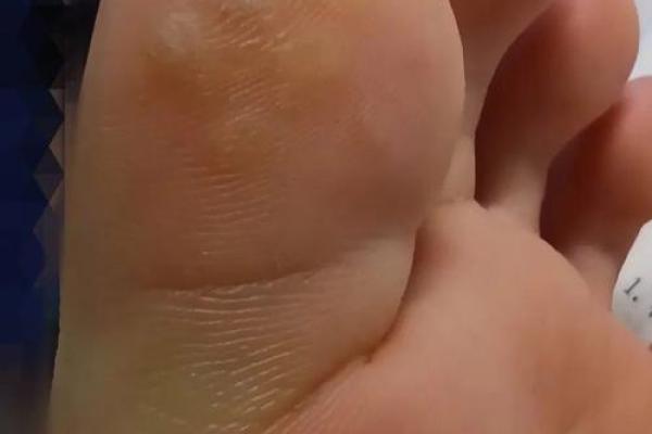 脚指头很长的命运解析：你是否也有这样的脚？