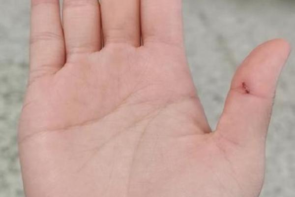 手上青筋暴露的命运解析：暗示着你内在的性格与命运走势