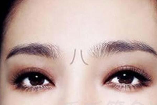 女人脖子有猴子纹的命运解读与生活启示