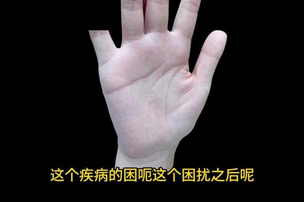 探秘手指凤眼纹：命运与性格的深刻联系