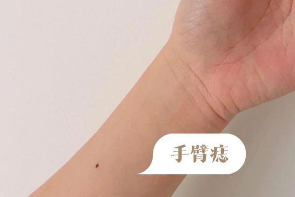 手腕上的对称痣：它们暗示了你的命运与性格！