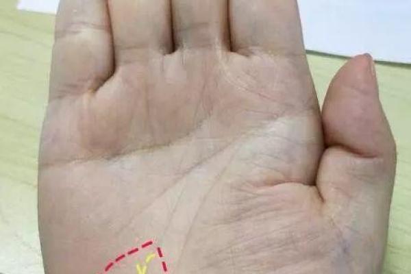 大拇指肥大命理解析：你的指尖藏着怎样的秘密？