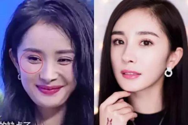 眼角有疤痕：命运的印记与自我重塑之路