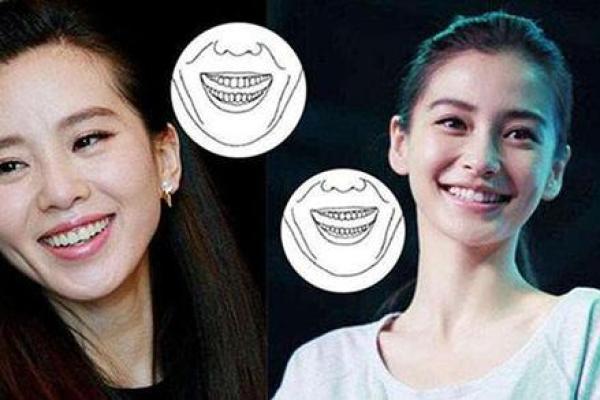 门牙内凹的人命运如何？探究内外因与命运的关联