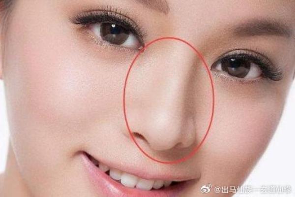 女人鼻头大的命运解析：独特面相与人生智慧的结合