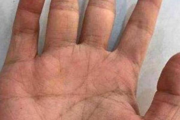 手纹不清晰的人生：探索命运的多样性与挑战