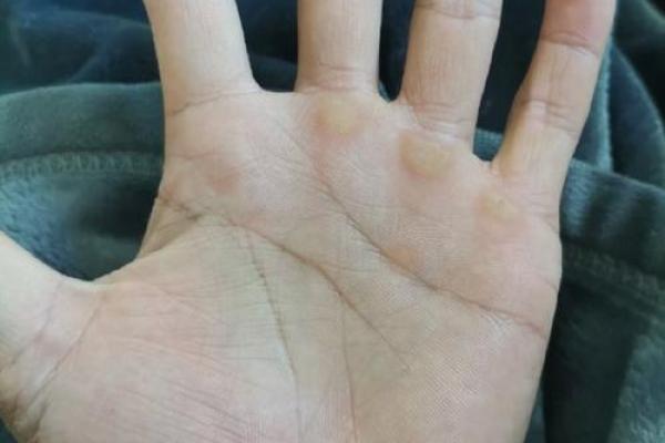 手纹不清晰的人生：探索命运的多样性与挑战