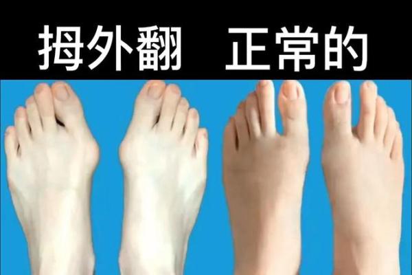 左脚大拇指短的命理解析：看看你和我有什么不同！