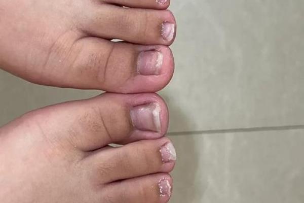 左脚大拇指短的命理解析：看看你和我有什么不同！