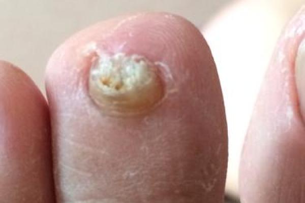 右脚比左脚大意味着什么？揭秘身体与命运的奇妙关联