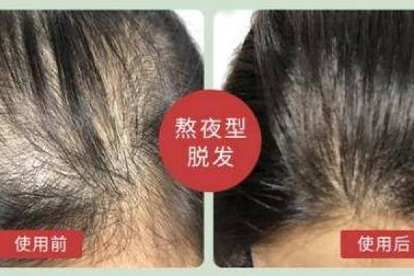 女生头发少的命运：发量与命运的奇妙关联