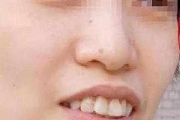 从下嘴唇看命理：面相中的财富与情感密码