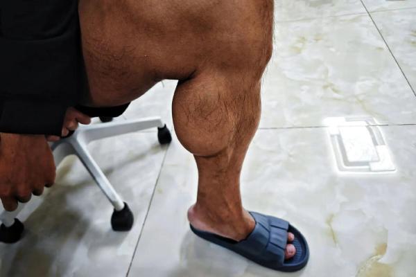 男人满腿毛，象征着什么命运与风情？