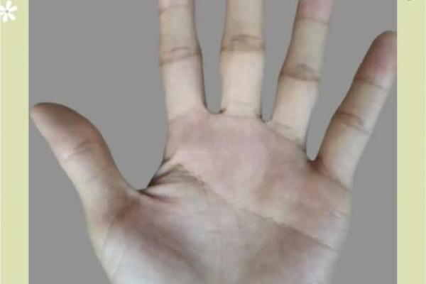 揭示手背青筋凸起的秘密：它暗示了你的命运与性格特征！
