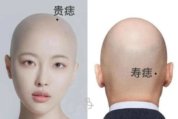 额头痣的神秘象征及其命运解析