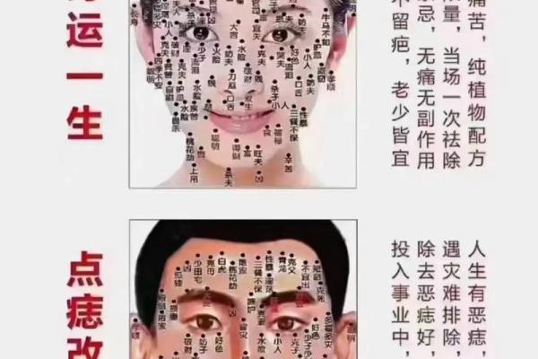 满脸痣的人在命理中象征着什么？解读痣相与命运的关系