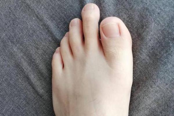 脚指头很长，这预示着什么命运和性格特征？