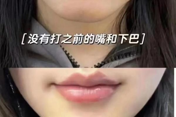 门牙内凹：从面相看你的命运与人生棋局