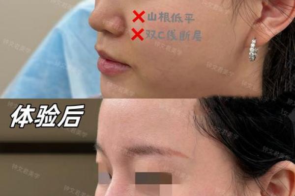 女生鼻子塌的命运分析：神秘面相与性格关系探讨