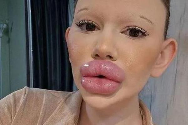 女性大嘴唇的命理解析：美丽与运势的奇妙关联