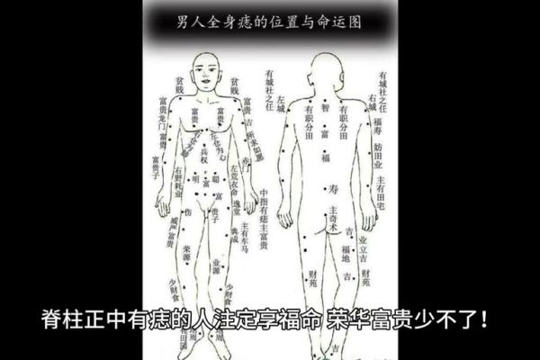 全身长痣揭秘：命理与痣的神秘联系，你的命运藏在哪里？