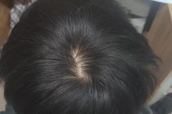 头发软的男人：你知道他们的命运与性格吗？