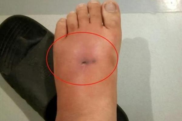 脚背高的人有什么命？探寻脚背高与命运的奥秘
