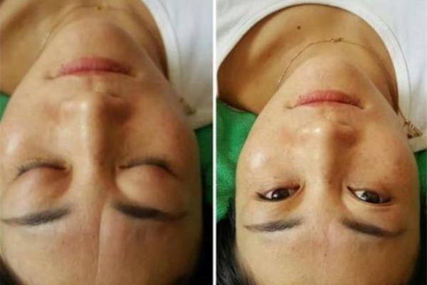 女人喉结长毛的秘密：命运与生活的深度解析