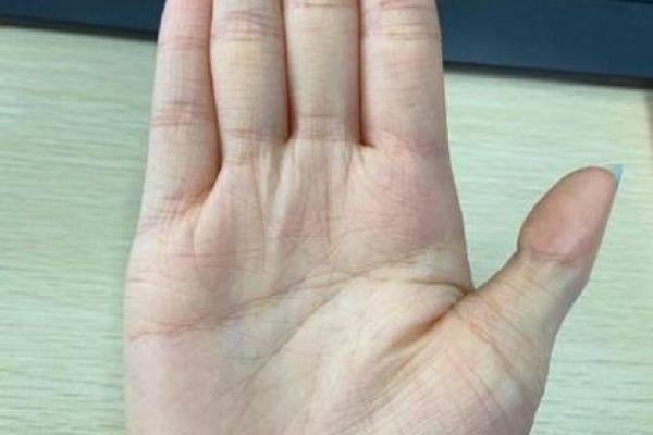 双手假断掌：命运与个性解析之旅