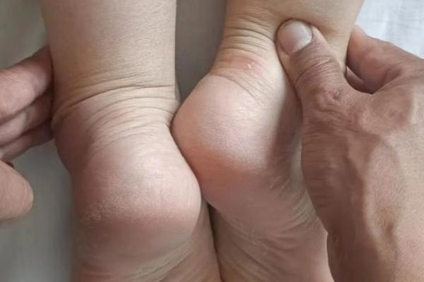 探索左腿短右腿长命理之谜，揭示身体与命运的关联